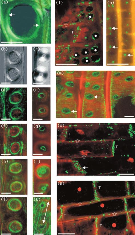 Indirect Immunouorescence Localisations Of Cytoskeletal Proteins And