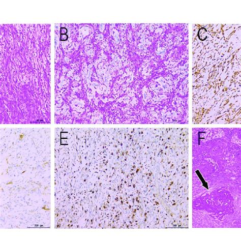 Histopathological Findings He Staining A ×40 B ×200 Show Download Scientific Diagram