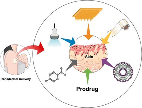 Microneedle Transdermal Drug Delivery System Market Analysis