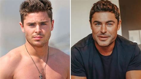 Zac Efron Recuperó Su Aspecto Habitual Y Reveló El Drama Que Vivió Y