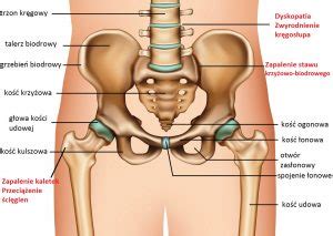 Choroba Zwyrodnieniowa Stawu Biodrowego Endoproteza Info Informator
