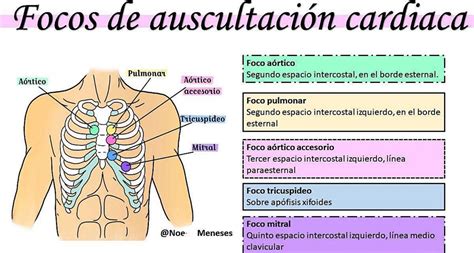 Auscultación Cardíaca