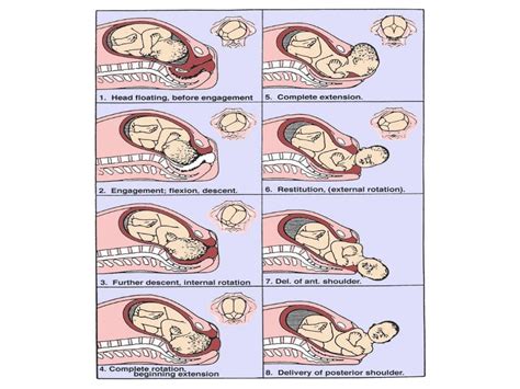 Mechanism Of Normal Labour