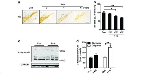 P M Induces Progressive Dopaminergic Neurodegeneration And