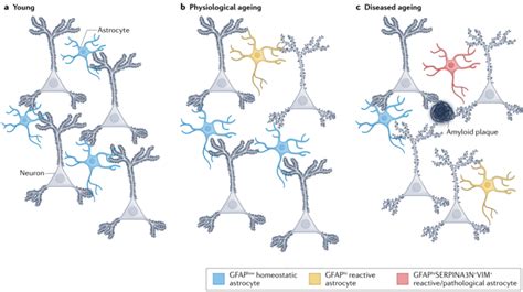 Nature Reviews Neuroscience综述星形胶质细胞在神经退行性疾病中的作用 腾讯新闻