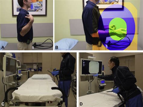 Optimizing Ergonomics Before Endoscopy Videogie