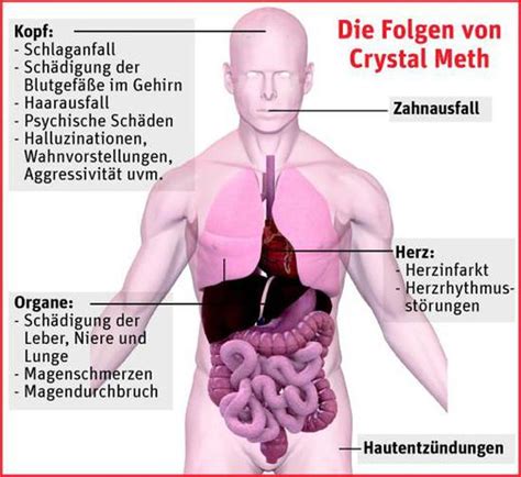 L Nderspiegel Der Konsum Von Crystal Meth Steigt Oberfranken Neue