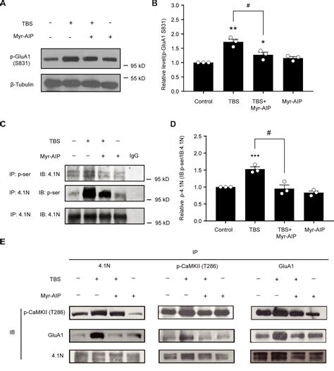 Phosphorylation Of N By Camkii Regulates The Trafficking Of Glua