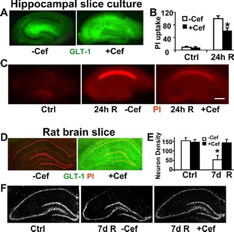 Figure 1 From Selective Dysfunction Of Hippocampal Ca1 Astrocytes