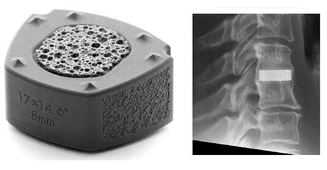 Silicon Nitride Encyclopedia Mdpi