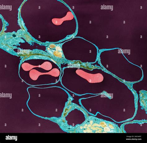 Lung Alveoli And Red Blood Cells Coloured Transmission Electron