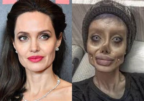 Mulher Faz Cirurgias Para Parecer Angelina Jolie E Resultado