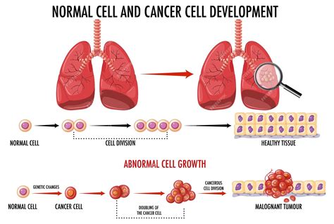 Diagramme Montrant Une Cellule Normale Et Une Cellule Cancéreuse Vecteur Gratuite