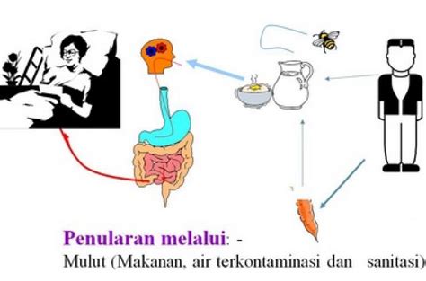 Gejala Tipes Pada Orang Dewasa Dan Pemulihannya