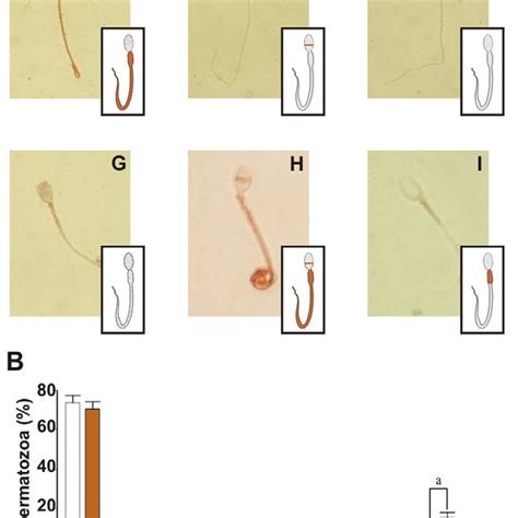 Molecular Mechanisms Involved In The Sperm Chemotaxis Mediated By