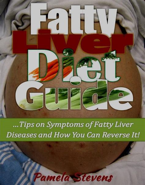 Fatty Liver Diet Guide Tips On Symptoms Of Fatty Liver Diseases And How You Can