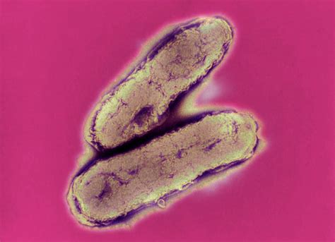 Haemophilus Influenzae Bacteria Photograph By A Dowsett Public Health England Science Photo