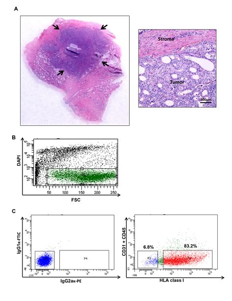 Isolation Of Cancer Stem Cells From Human Prostate Cancer Samples