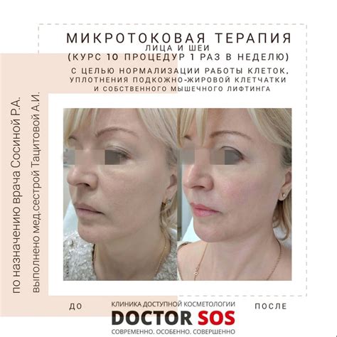Микротоковая терапия | Клиника Инновационной Косметологии DoctorSOS