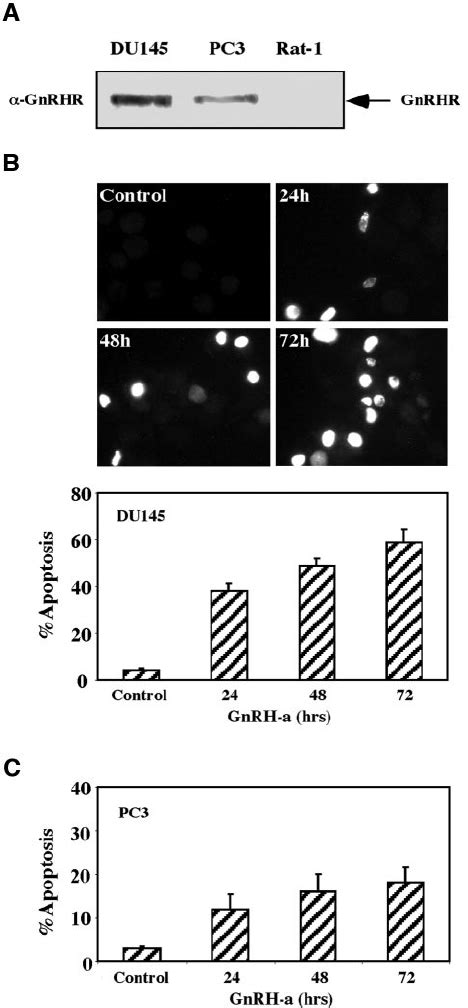 GnRH A Induces Apoptosis Of DU145 Cells A Expression Of GnRH Receptor