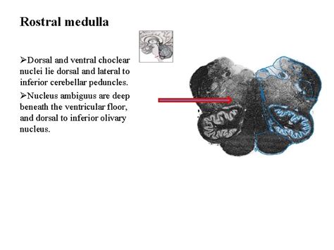 Internal Structure Of Medulla Oblongata By Essam Eldin