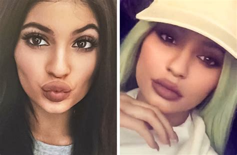 Kylie Jenner Shuts Down Rumors That Shes Had Too Much Surgery On Her