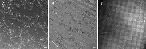 Matrigel Assay Images Of Capillary Like Tube Formation Of HDMECs After