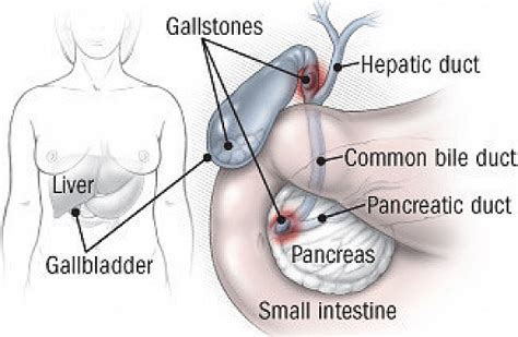 Bile Duct Diseases Harvard Health