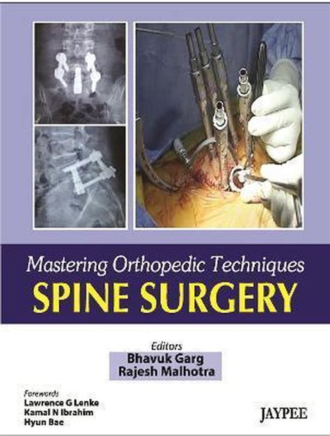 Mastering Orthopaedic Techniques Spine Surgery 9788184488968 Bhavuk