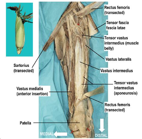 Quadriceps Muscles Diagram