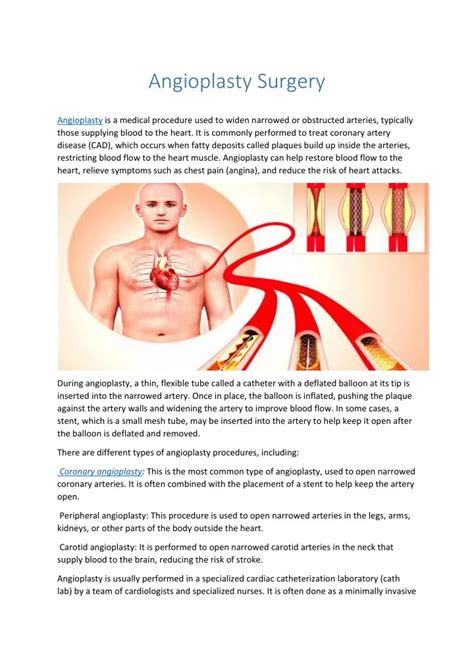 Ppt Angioplasty Surgery Powerpoint Presentation Free Download Id