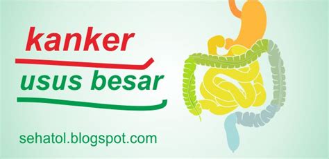 Kanker Usus Besar Penyebab Gejala Ciri Ciri And Pengobatannya Tips