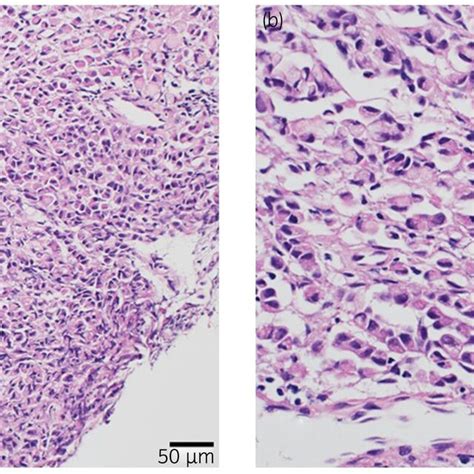 Histopathological Findings With A Median Magnification 100× And B Download Scientific