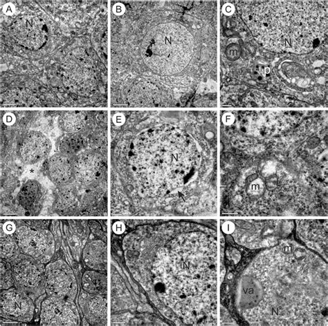 Transmission Electron Micrographs Of Kenyon Cells Of The Brain Of A