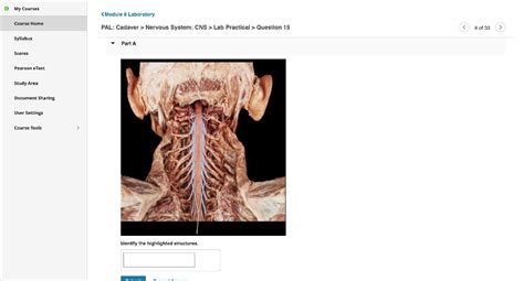 Solved Pal Cadaver Nervous System Cns Lab Practical Chegg