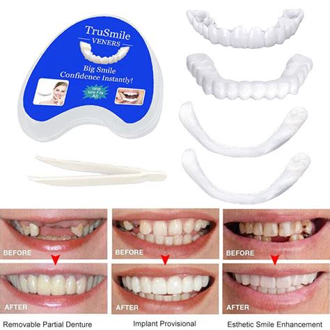 Smile Snap On False Teeth Upper Lower Dental Veneers Dentures Tooth Cover Set Artofit