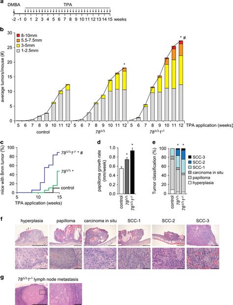 Atypical E Fs Inhibit Tumor Growth And Progression In Dmba Tpa Induced