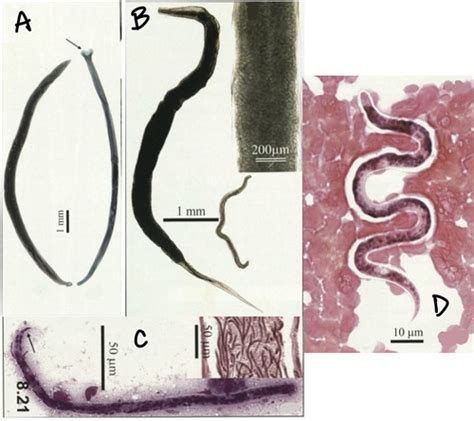 Nematodes Part Flashcards Quizlet