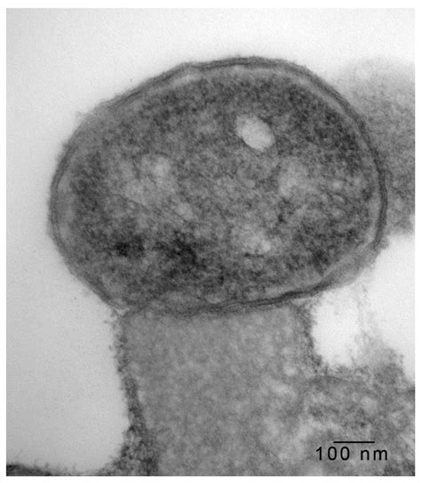 Microorganisms Free Full Text Intimate Attachment Of Escherichia