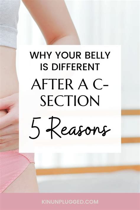 Comparing Stomach Changes C Section Vs Natural Birth What To Expect