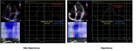 Strain Card Aco Blog Ecope