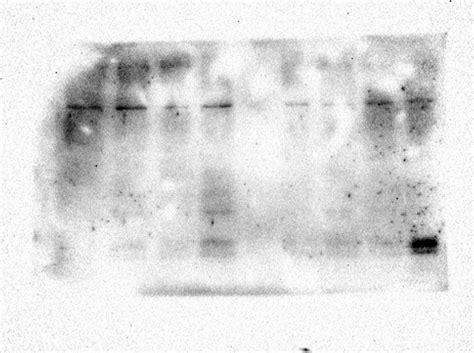 Western Blot Membrane