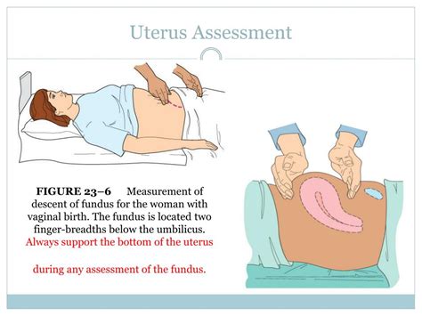 Ppt Postpartum Nursing Care Powerpoint Presentation Free Download Id 948173