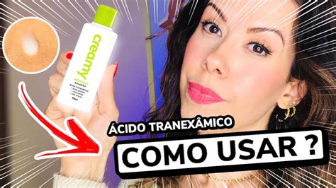 Solução CLAREADORA de MELASMA e MANCHAS na Pele Creamy Ácido