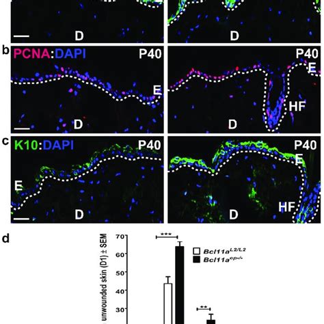 Conditional Ablation Of Bcl11a In Adult Epidermis Leads To Enhanced