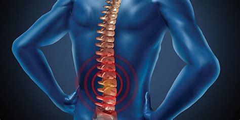 Back to Basics: Reducing Workplace Back Injuries | The EI Group