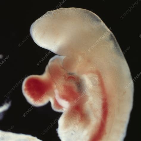 Human Embryo 4 Weeks