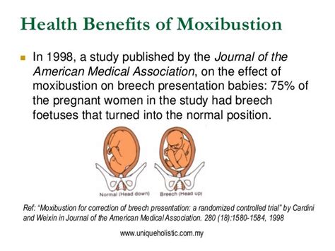 Moxibustion & Its Health Benefits