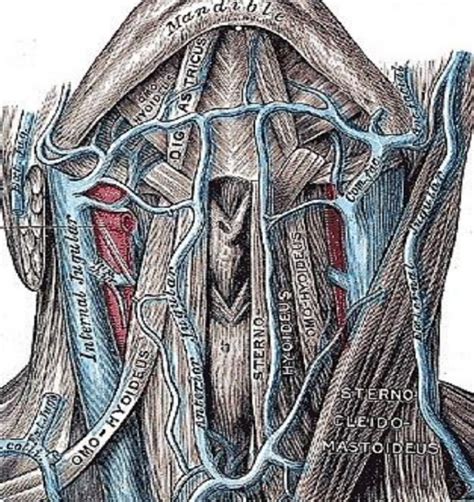 514 Submental Artery Island Flap Technique For Head And Neck