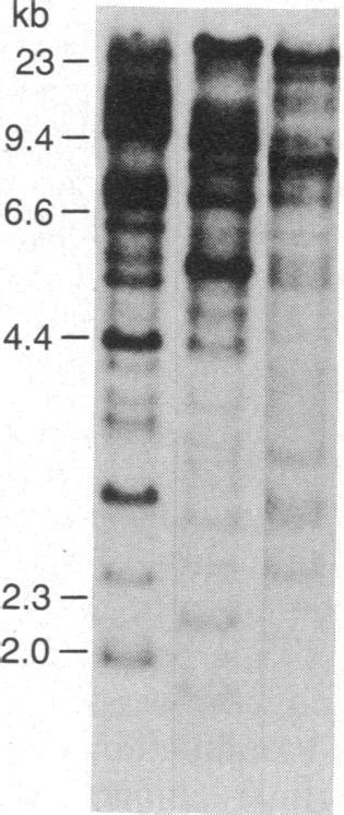 Southern Blot Hybridization Of Rat Dna With The Ppg 1 Cdna Probe Rat